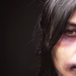 Domestic-violence-victim-01