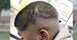 Photo of Juelz Trice's scalp aftert Sharpie was used on his head by three White Pearland ISD employees.