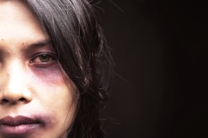 Domestic-violence-victim-12