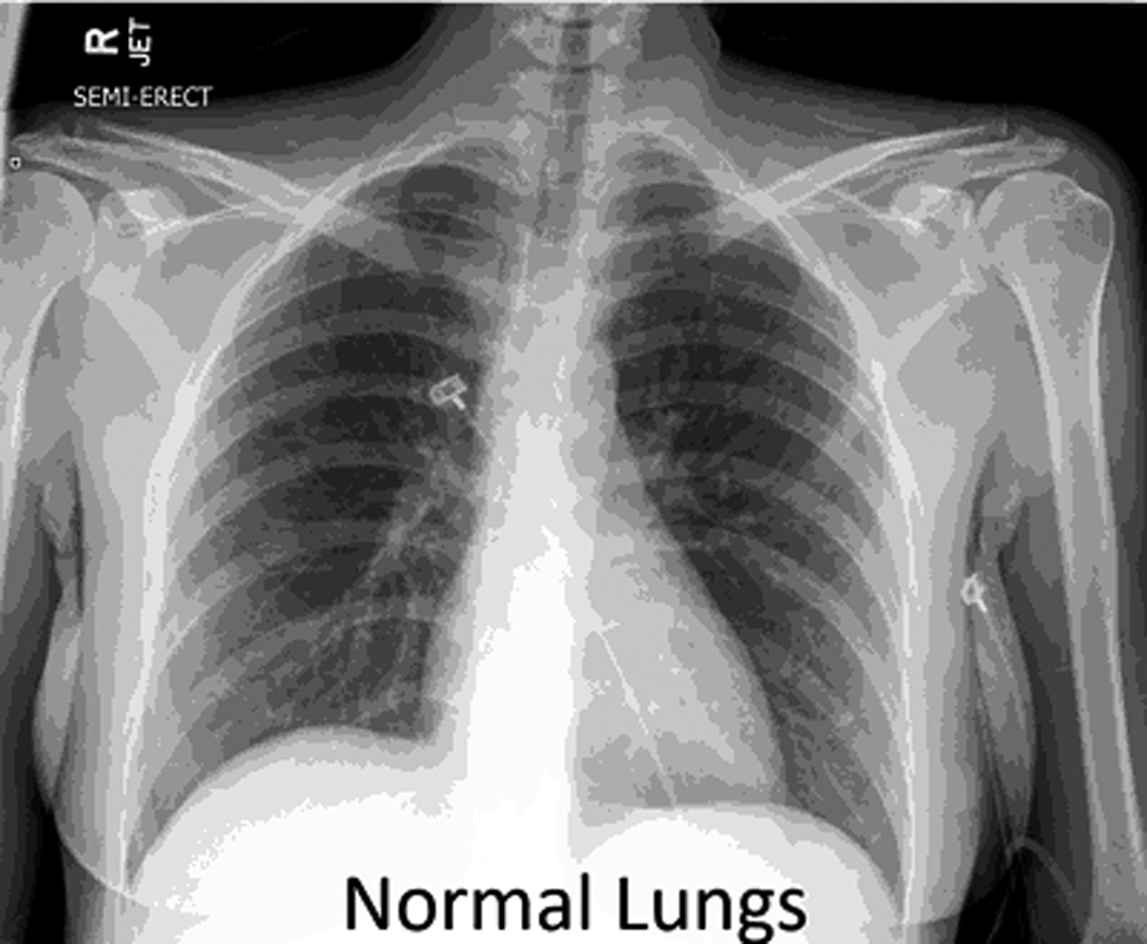 clear-lungs-051120-new-orleans-multicultural-news-source-the