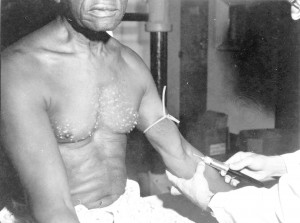 A participant in the 'Tuskegee Study of Untreated Syphilis in the Negro Male,' a government-sponsored study in the 1930s. A lingering mistrust of the medical system among many Black people is rooted in the infamous study that was officially shut down in 1972. Photo courtesy of National Archives via NPR